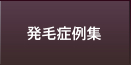 発毛症例集